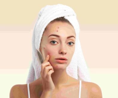 solusi-terbaik-untuk-kulit-bebas-jerawat-dengan-terapi-acne solusi-terbaik-untuk-kulit-bebas-jerawat-dengan-terapi-acne