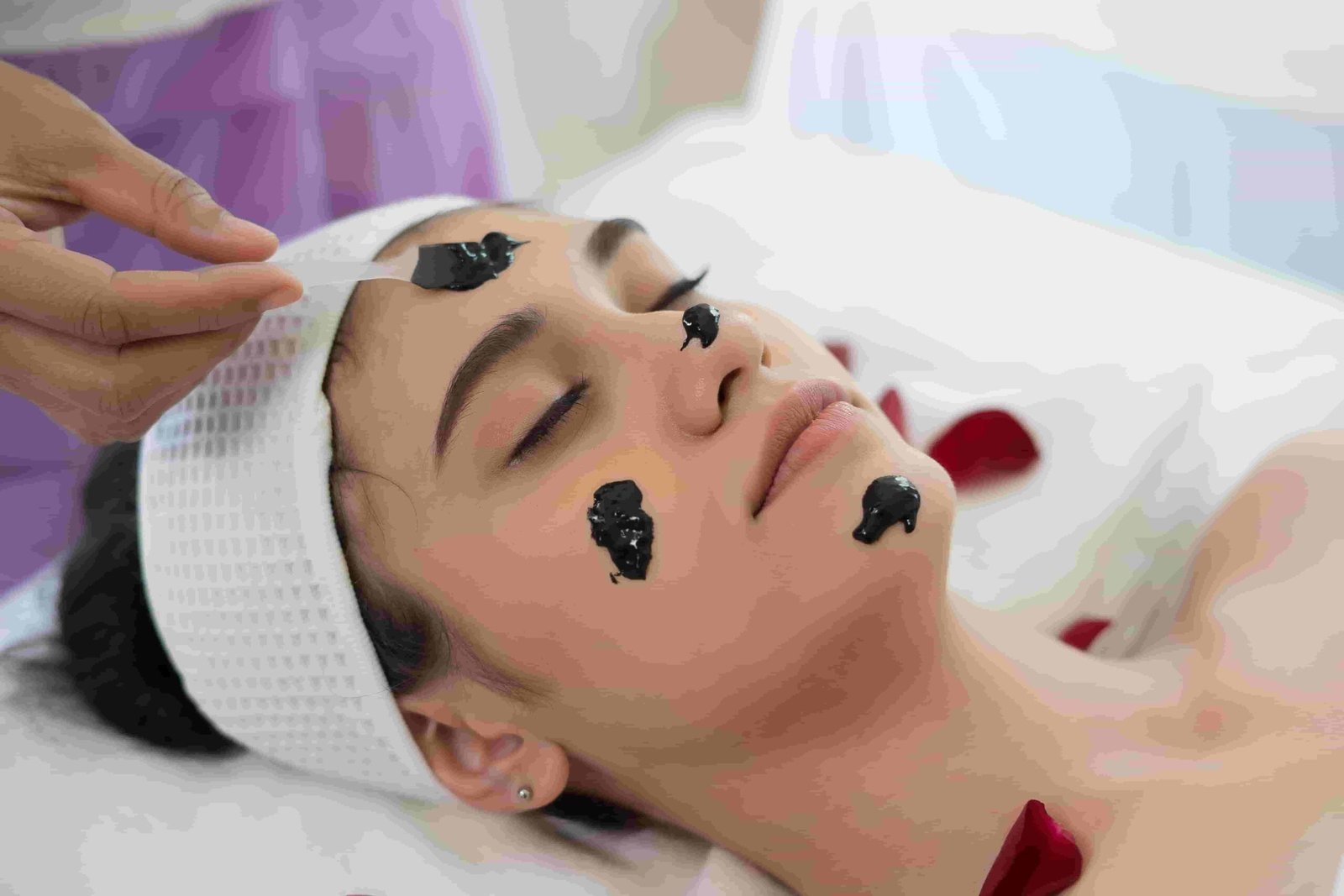 terapi-black-spot-di-lavalen-medica-solusi-kulit-bersih