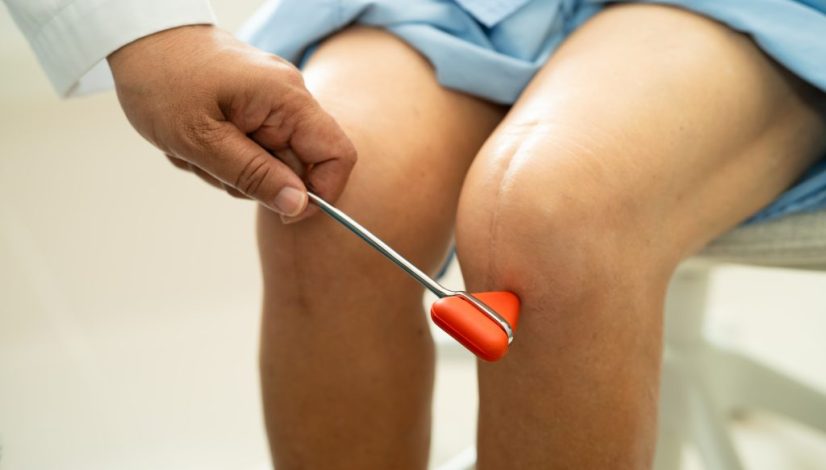 osteoartritis obesitas