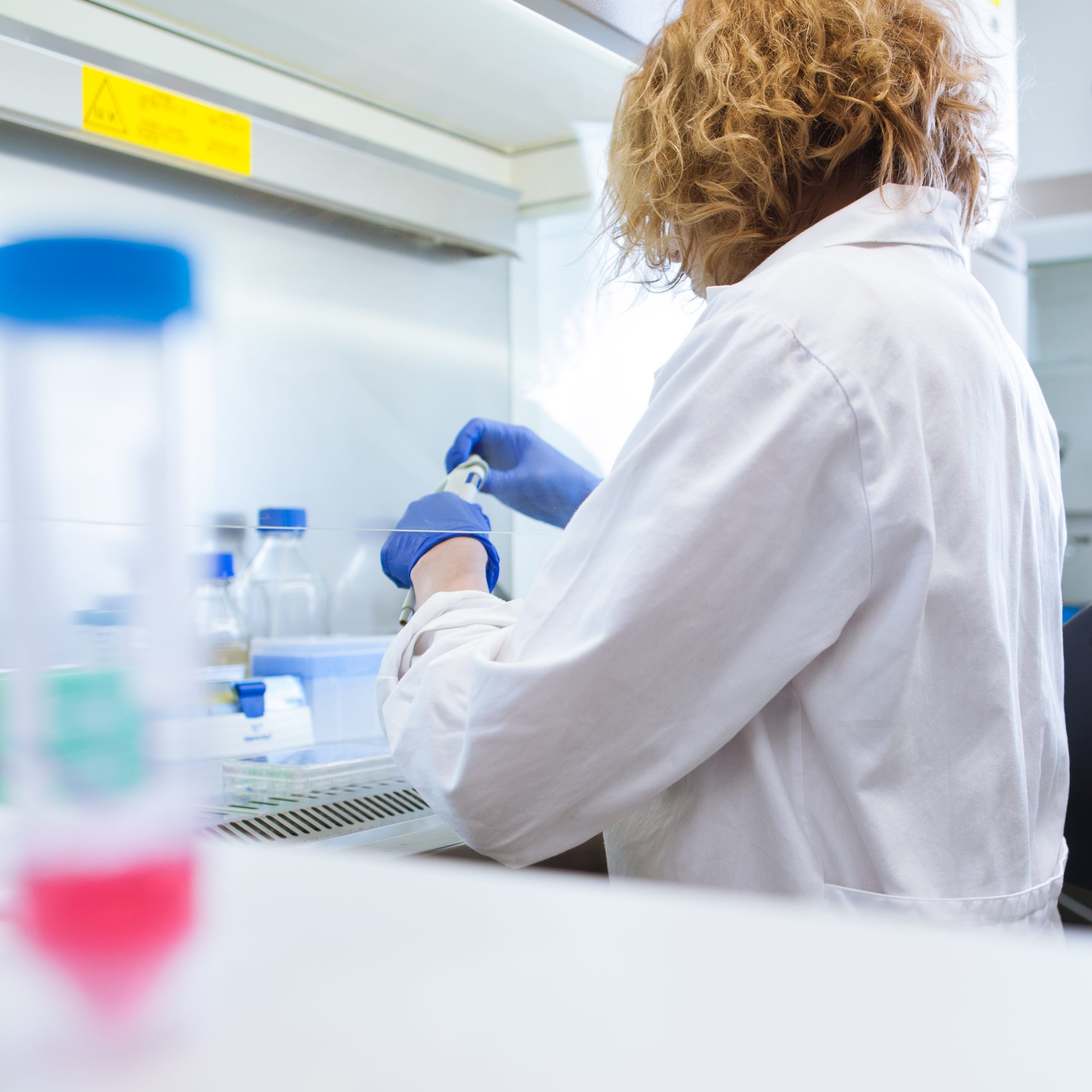 Stem Cell Autologous