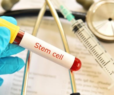 Stem Cell