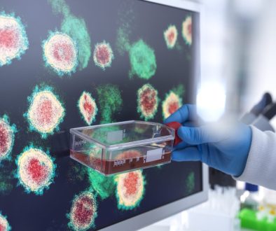 Stem Cell Autologous