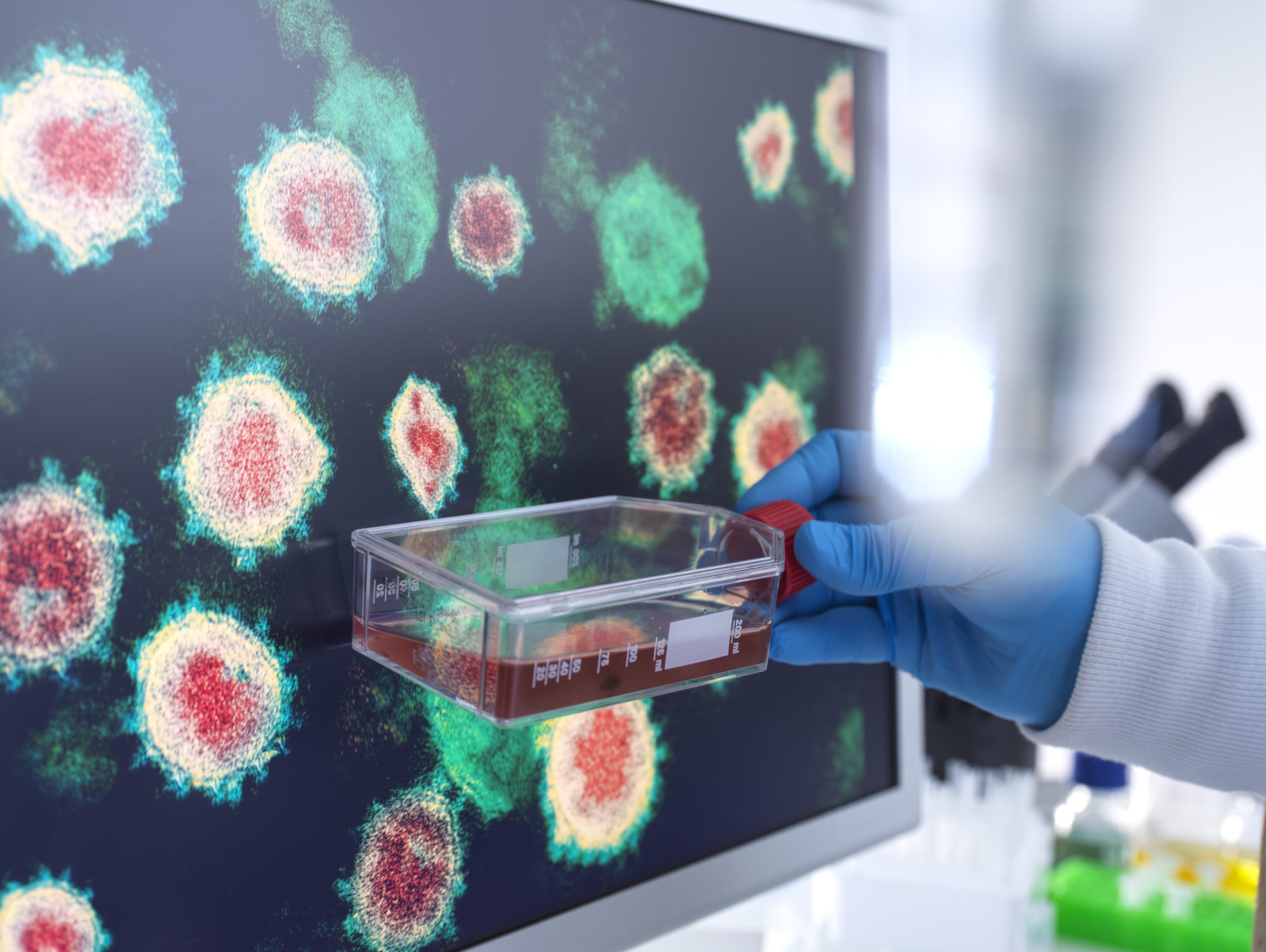 Stem Cell Autologous