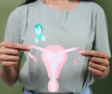 Penyebab PCOS Pada Perempuan Lavalen Medica
