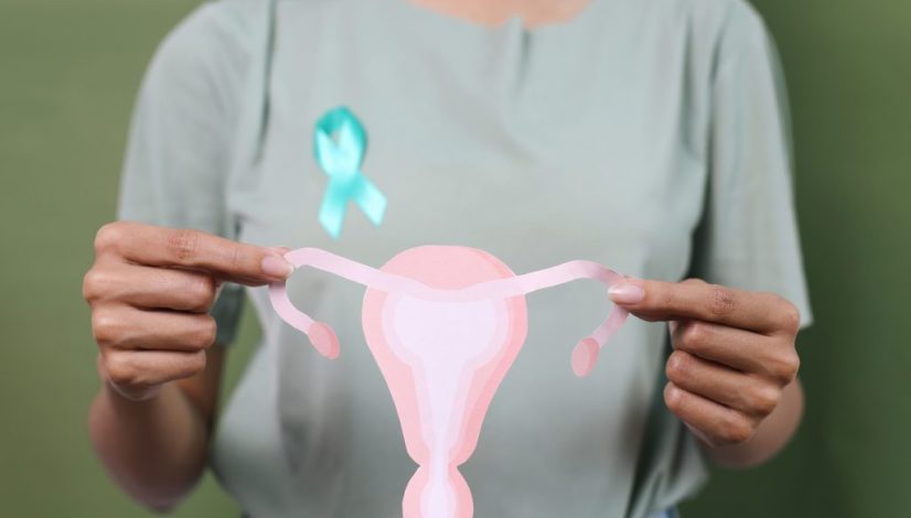 Penyebab PCOS Pada Perempuan Lavalen Medica