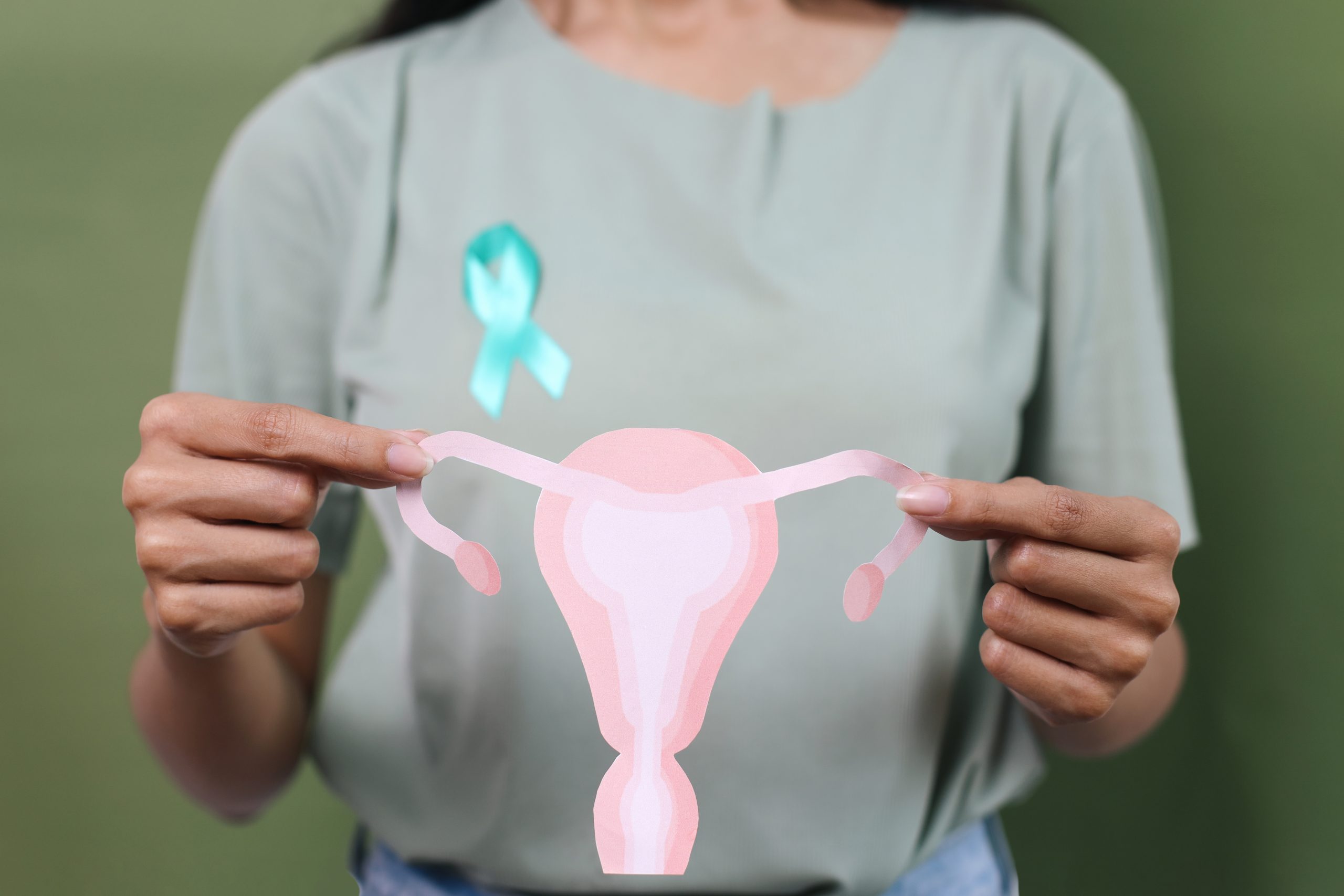 Penyebab PCOS Pada Perempuan Lavalen Medica
