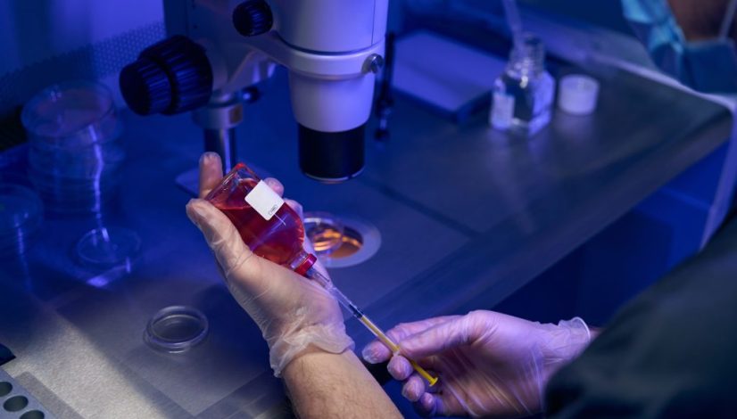 Terapi Stem Cell Autologous Lavalen Medica