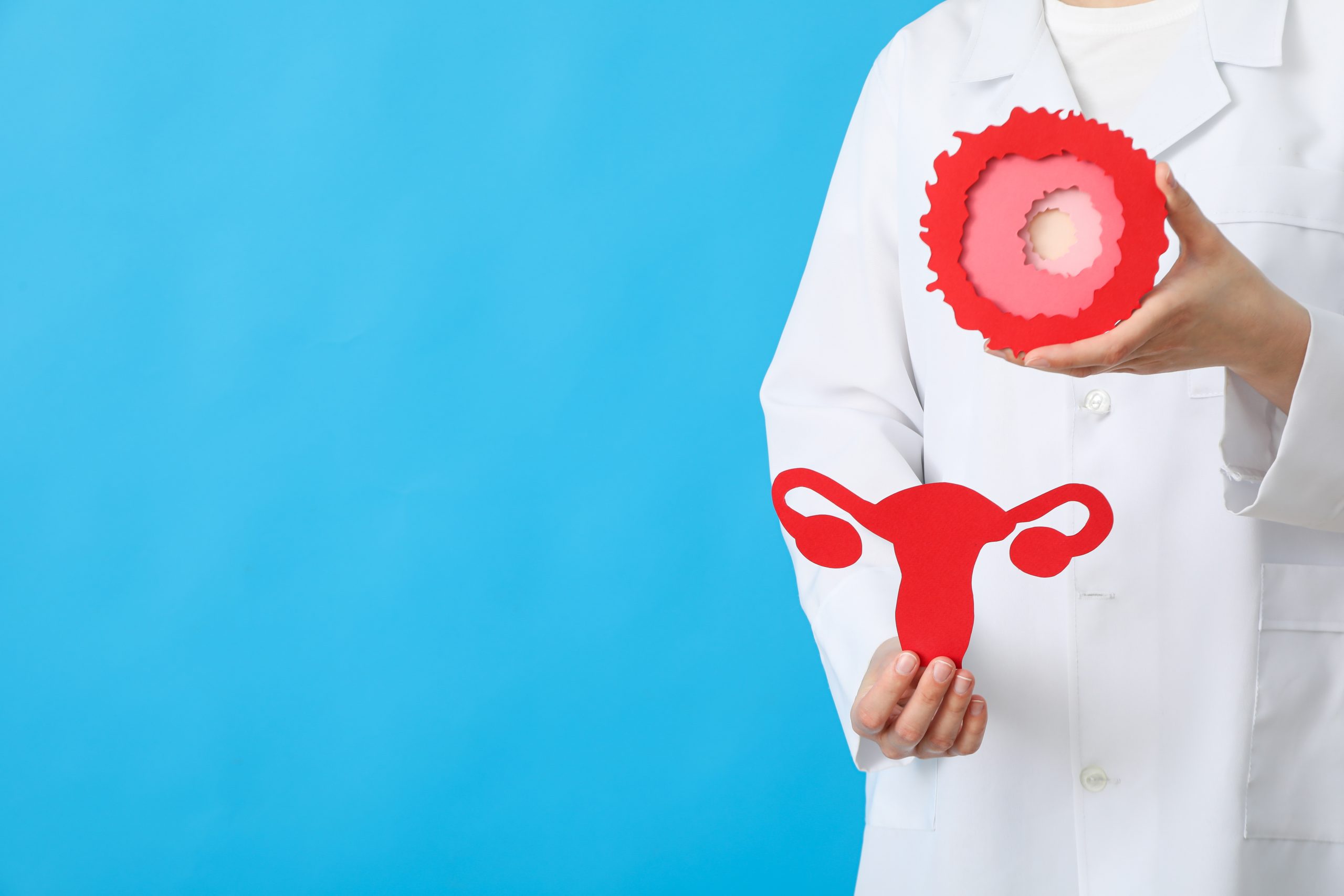 Apa Itu PCOS Lavalen Medica