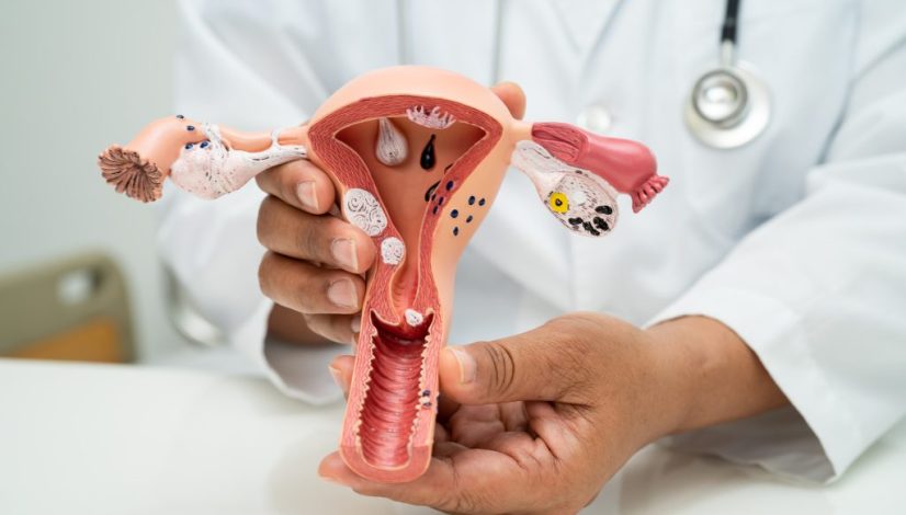 Kesehatan Organ Reproduksi