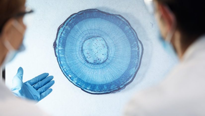 keamanan stem cell lavalen medica