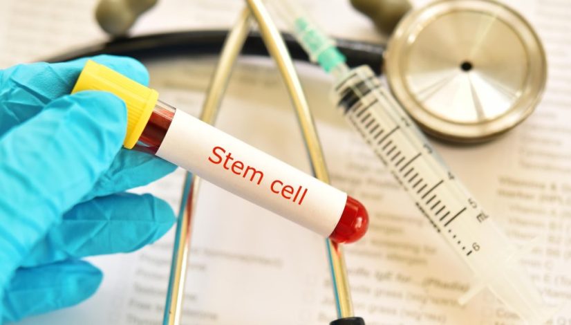 Terapi Stem Cell untuk Autoimun