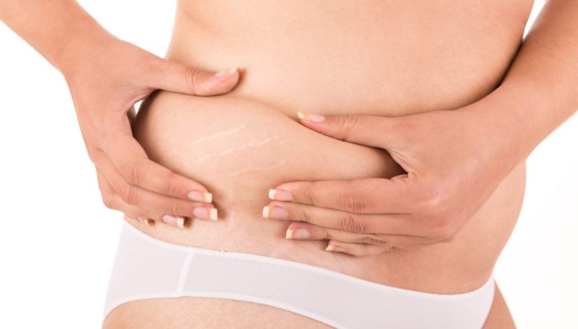 menurunkan berat badan di lavalen medica