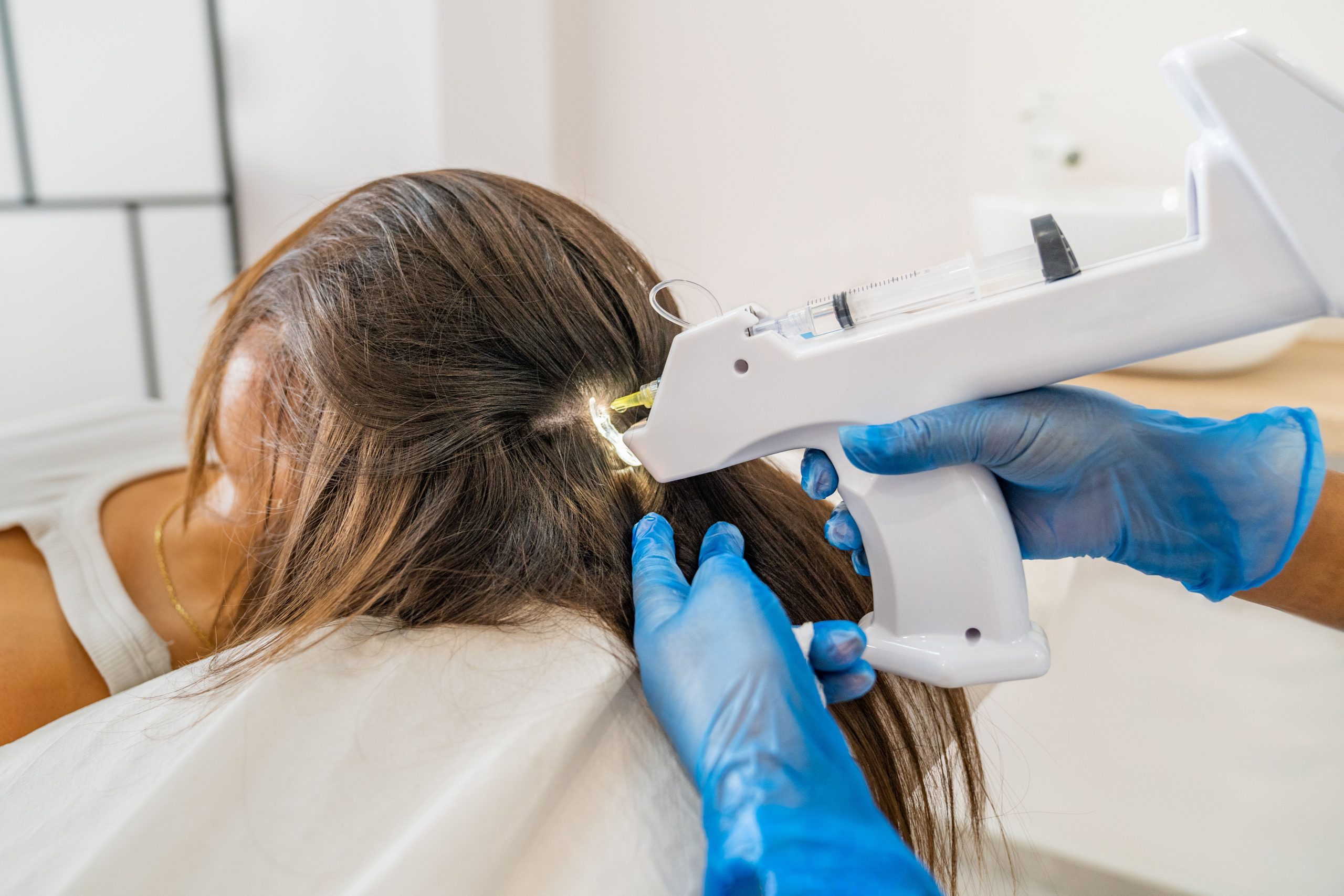 Exosome Hair Grow Jakarta di lavalen medica