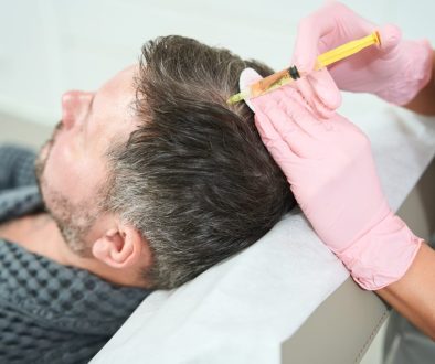 exosome hair treatment di lavalen medica