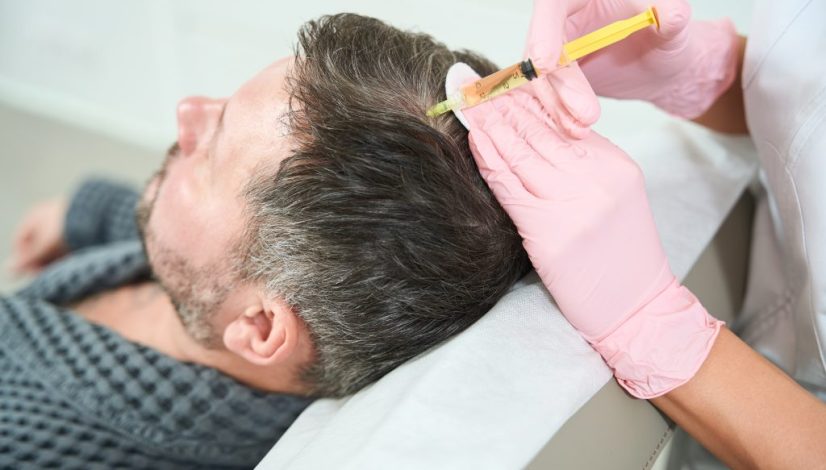 exosome hair treatment di lavalen medica