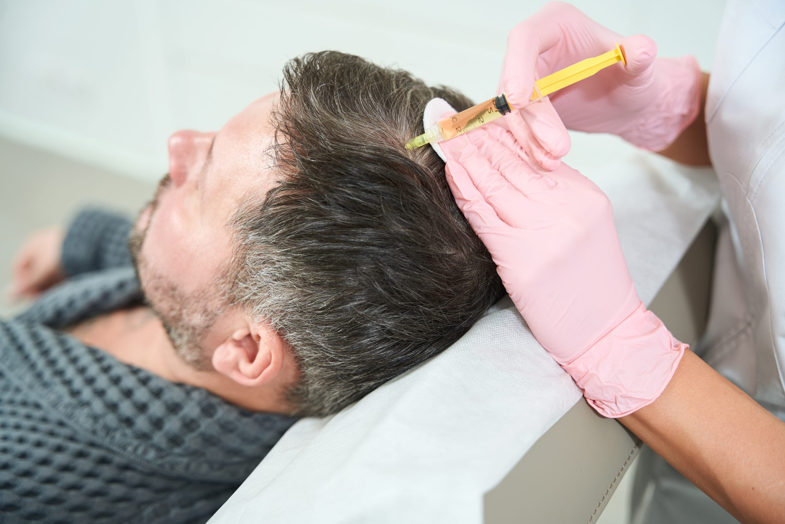 exosome hair treatment di lavalen medica