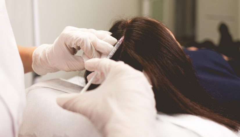 klinik exosome rambut lavalen medica