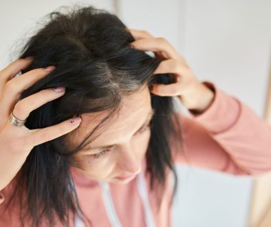 timbul jerawat dan rambut rontok tanda ada penyakit lavalen medica