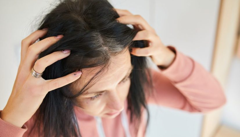 timbul jerawat dan rambut rontok tanda ada penyakit lavalen medica