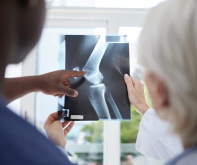 penanganan osteoarthritis obesitas di lavalen medica
