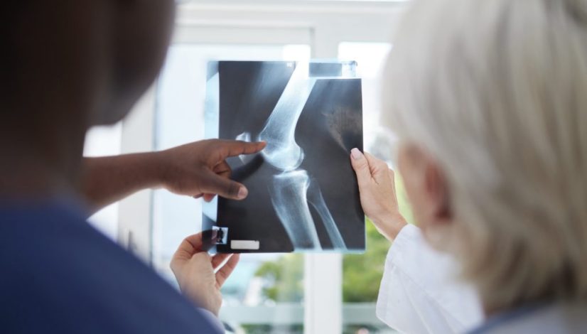 penanganan osteoarthritis obesitas di lavalen medica