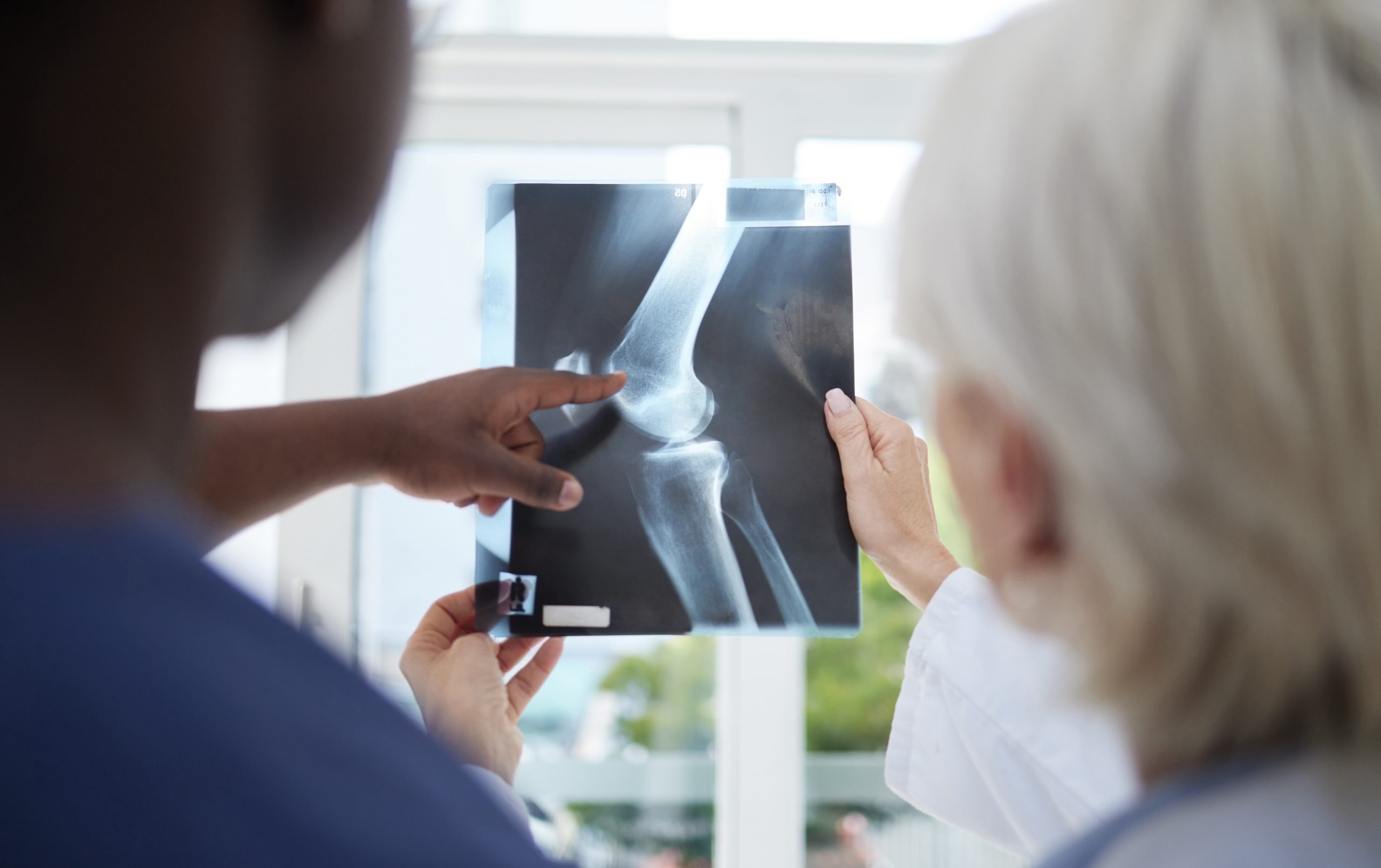 penanganan osteoarthritis obesitas di lavalen medica