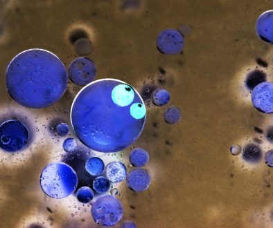 Terapi R3 Stem Cell di lavalen medica