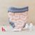 gut brain axis adalah