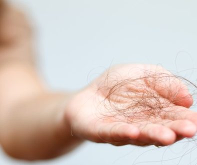 secretome untuk rambut rontok