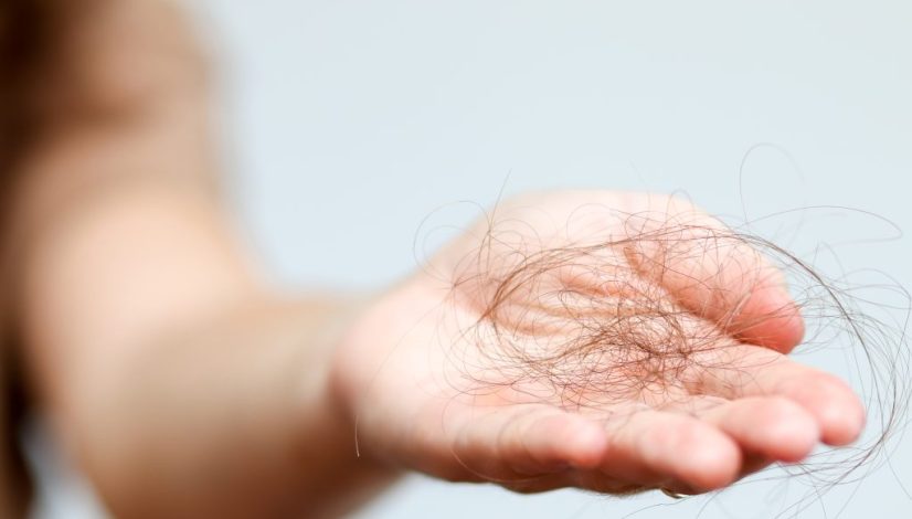 secretome untuk rambut rontok
