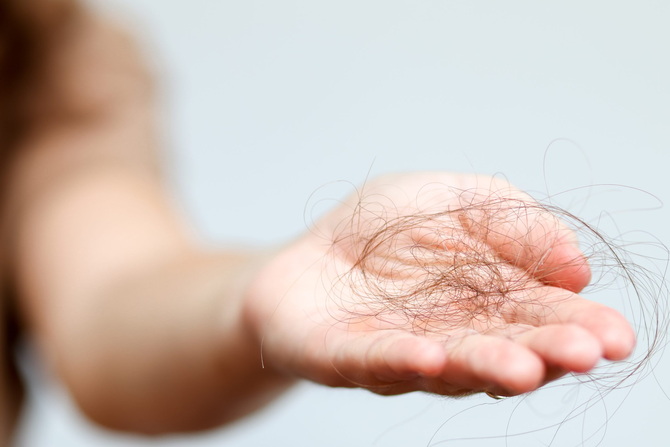 secretome untuk rambut rontok