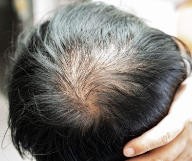 exosome untuk rambut