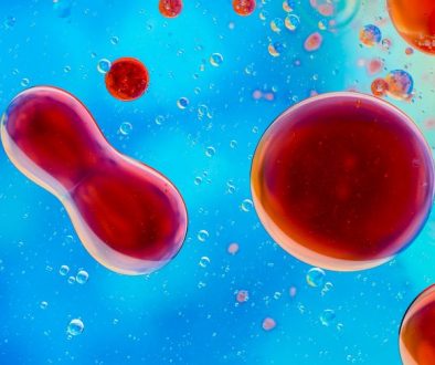 autologous stem cell adalah